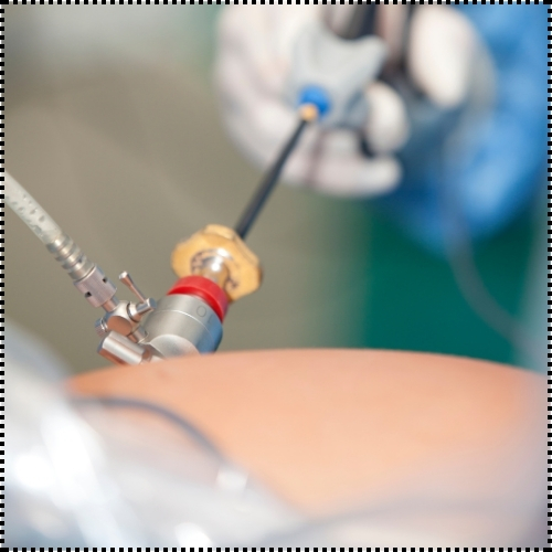 Benefits of Mini Laparoscopy - Healix Hospitals